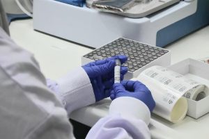 Mesin Otomatis Pacu Uji Sampel Covid-19 di Eijkman 2,5 Kali Lipat