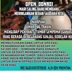 Mengidap Tumor Ganas, Nurpiah Warga Pulau Panggung Butuh Perhatian Pemerintah