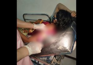 Orang dengan Gangguan Jiwa Bacok Pasutri, Satu Korban Meninggal Dunia