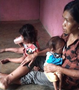 Faktor Ekonomi, Jevanya Diduga Gizi Buruk di Kabupaten Bengkayang