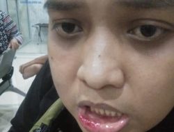 Berawal dari Cekcok Mulut, 3 Warga Lebung Curup Dikeroyok 7 Orang