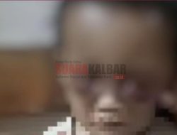 Miris, Kedua Mata Balita Ini Lebam Akibat Dianiaya Ibu Kandungnya Sendiri, Netizen: Memang Biadab