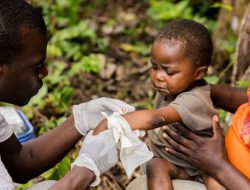 WHO Rilis Statistik Cacar Monyet untuk Afrika