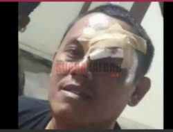 Wartawan Diculik dan Dianiaya Kemudian Dicekoki Air Kencing, Pelaku Diduga Oknum Pejabat Pemerintah