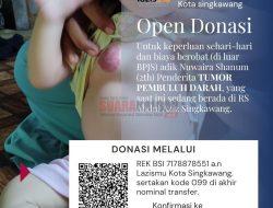 Nuwaira Shanum Bocah Berusia 2 Tahun di Singkawang Butuh Uluran Tangan