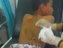 Santri Pondok Tahfidz di Parepare Jadi Korban Penganiayaan, Diduga Disetrika hingga Luka Bakar