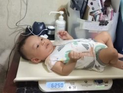 Pentingnya Intervensi Dini dalam Mengatasi Keterlambatan Perkembangan Motorik Anak