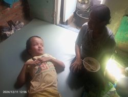 Bocah Sebelas Tahun, Penderita Hydrocepalus Harapkan Bantuan Operasi Rumah Sakit Polri
